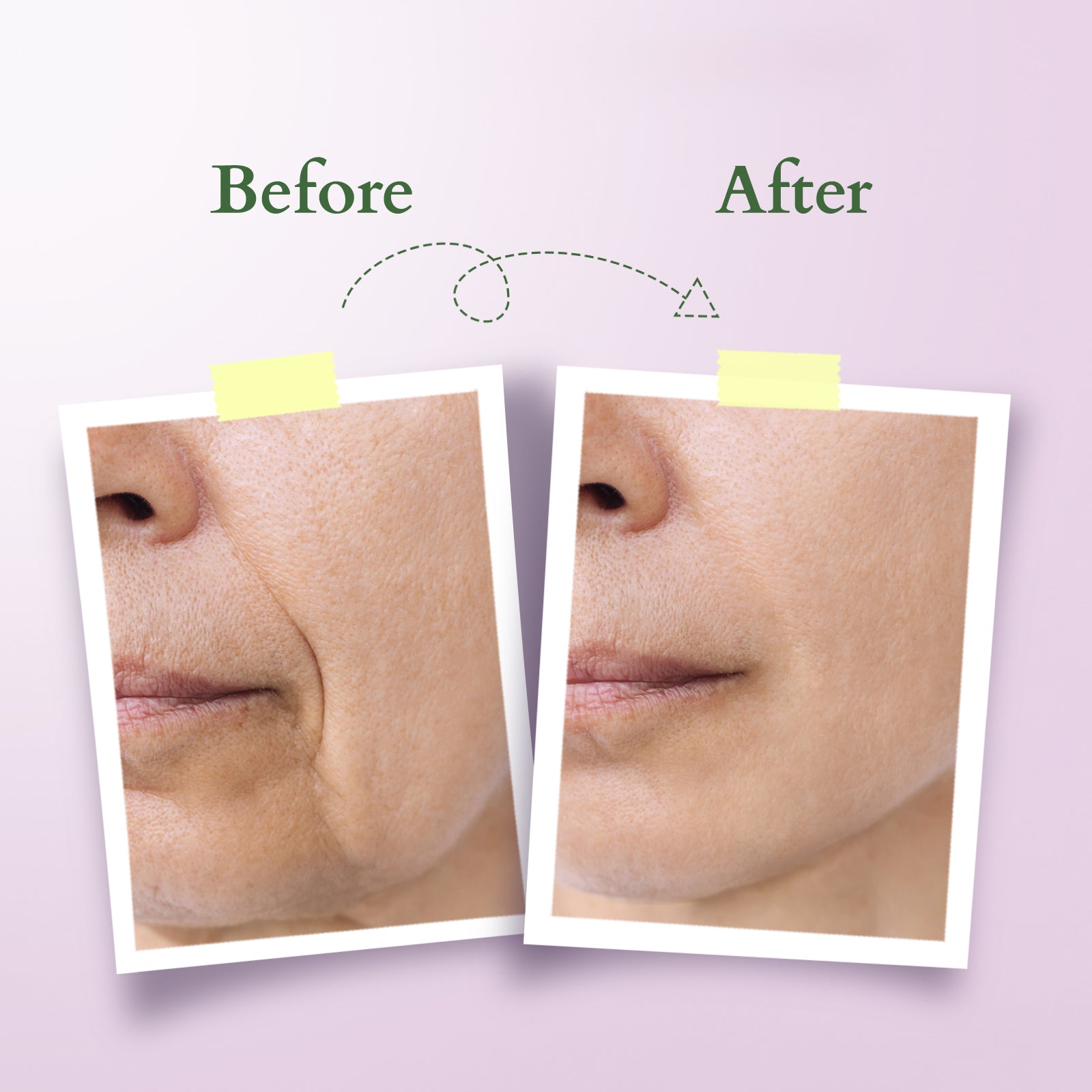 Bakuchiol Plant Retinol Miracle Face Oil