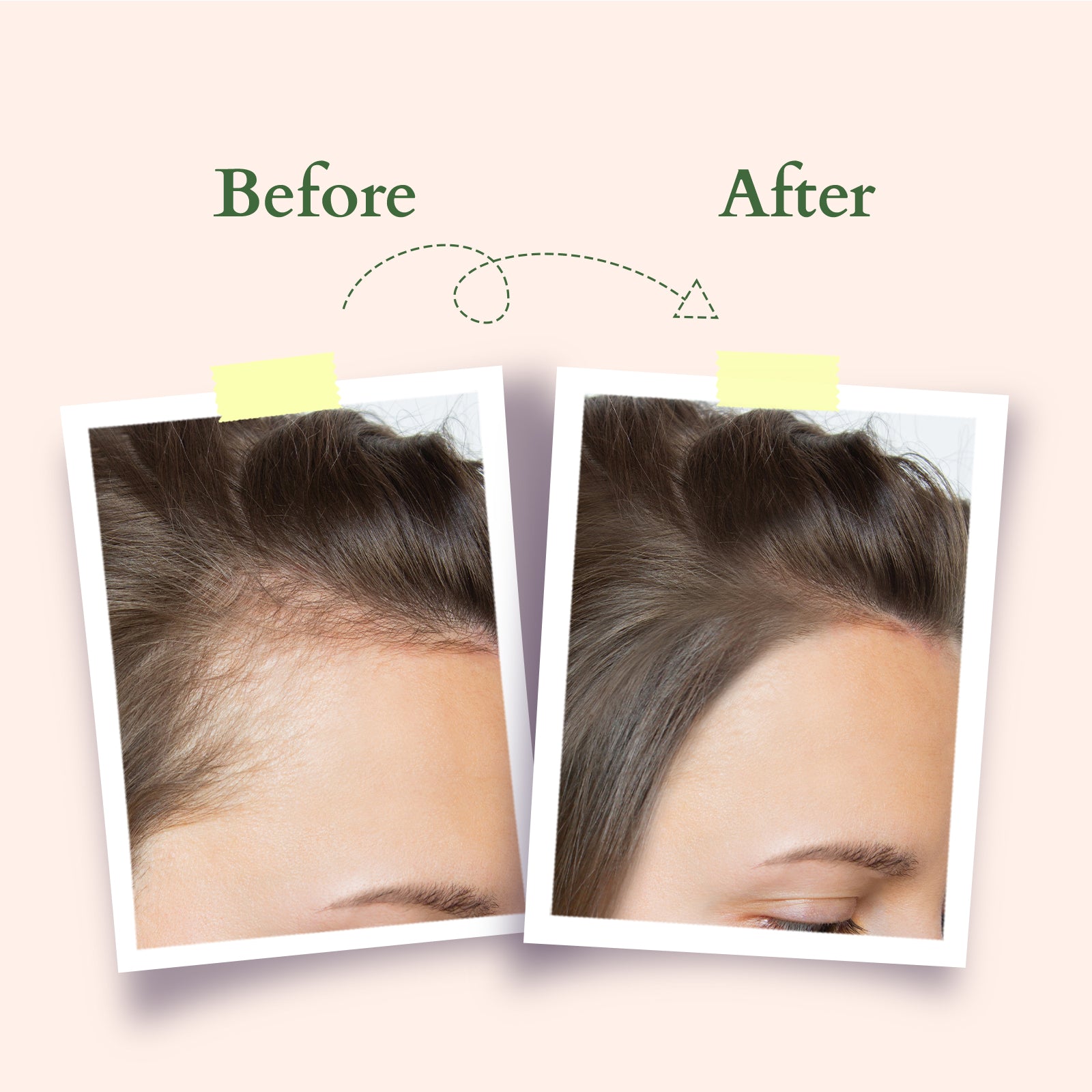 Organics+ Hair Fall Control Shampoo