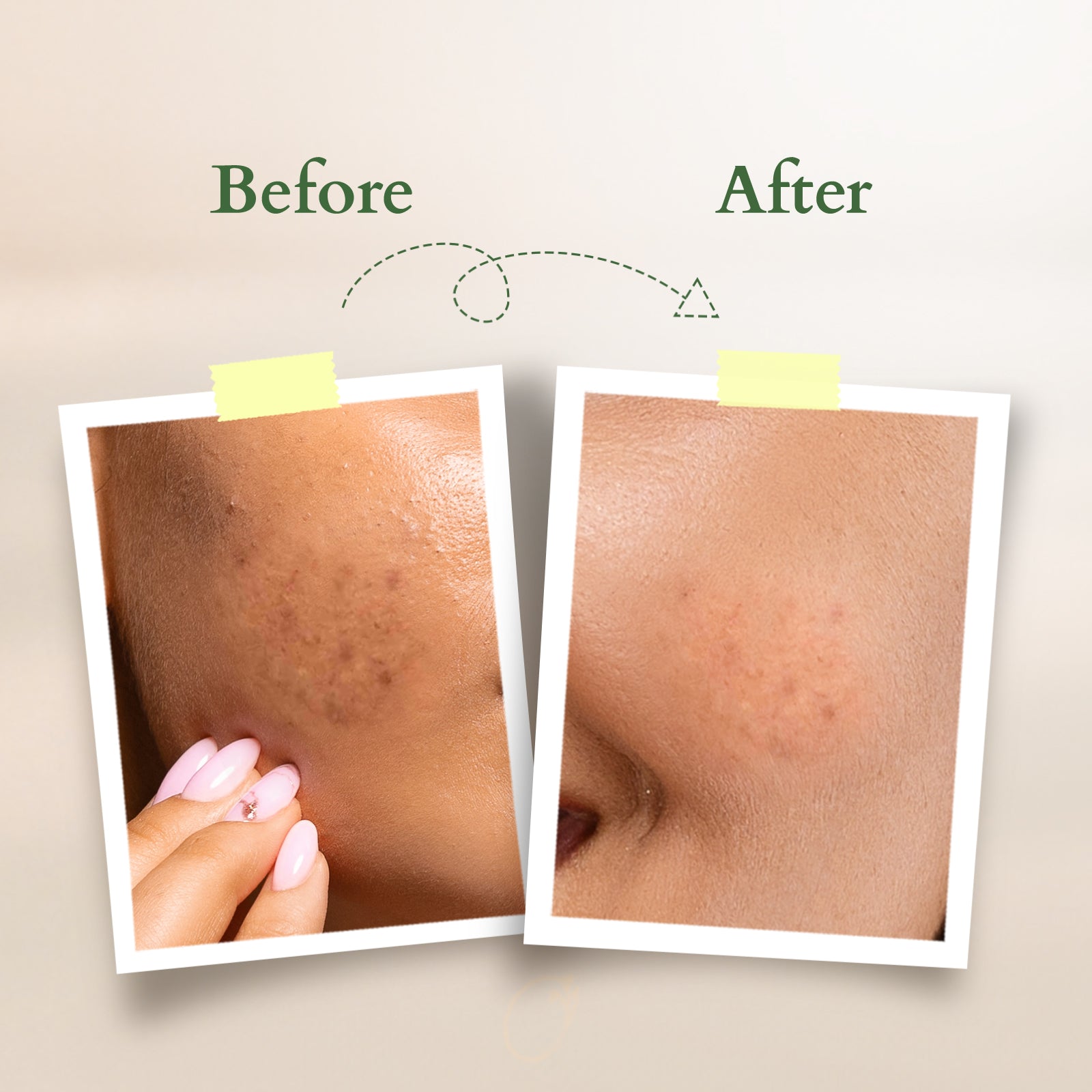 Organics+ Vitamin-C Glow Face Oil