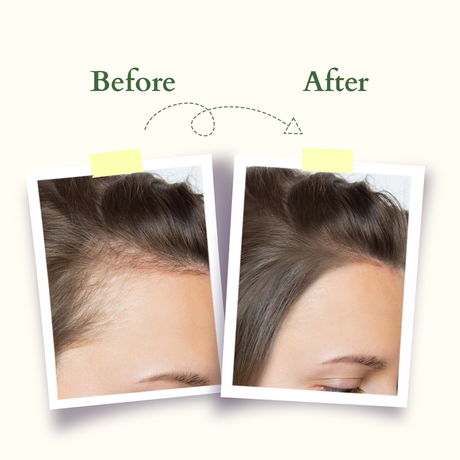 Organics+ Intensive Scalp Revitalizing Oil