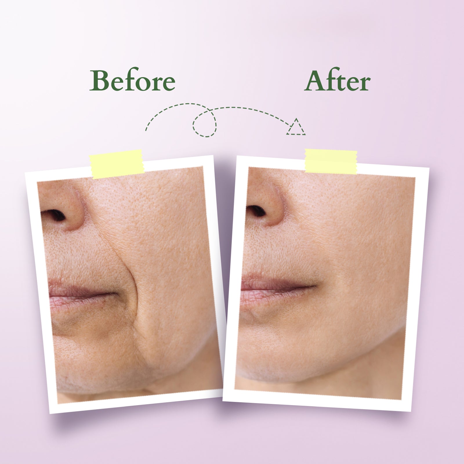 Bakuchiol Plant Retinol Oil to Foam Cleanser