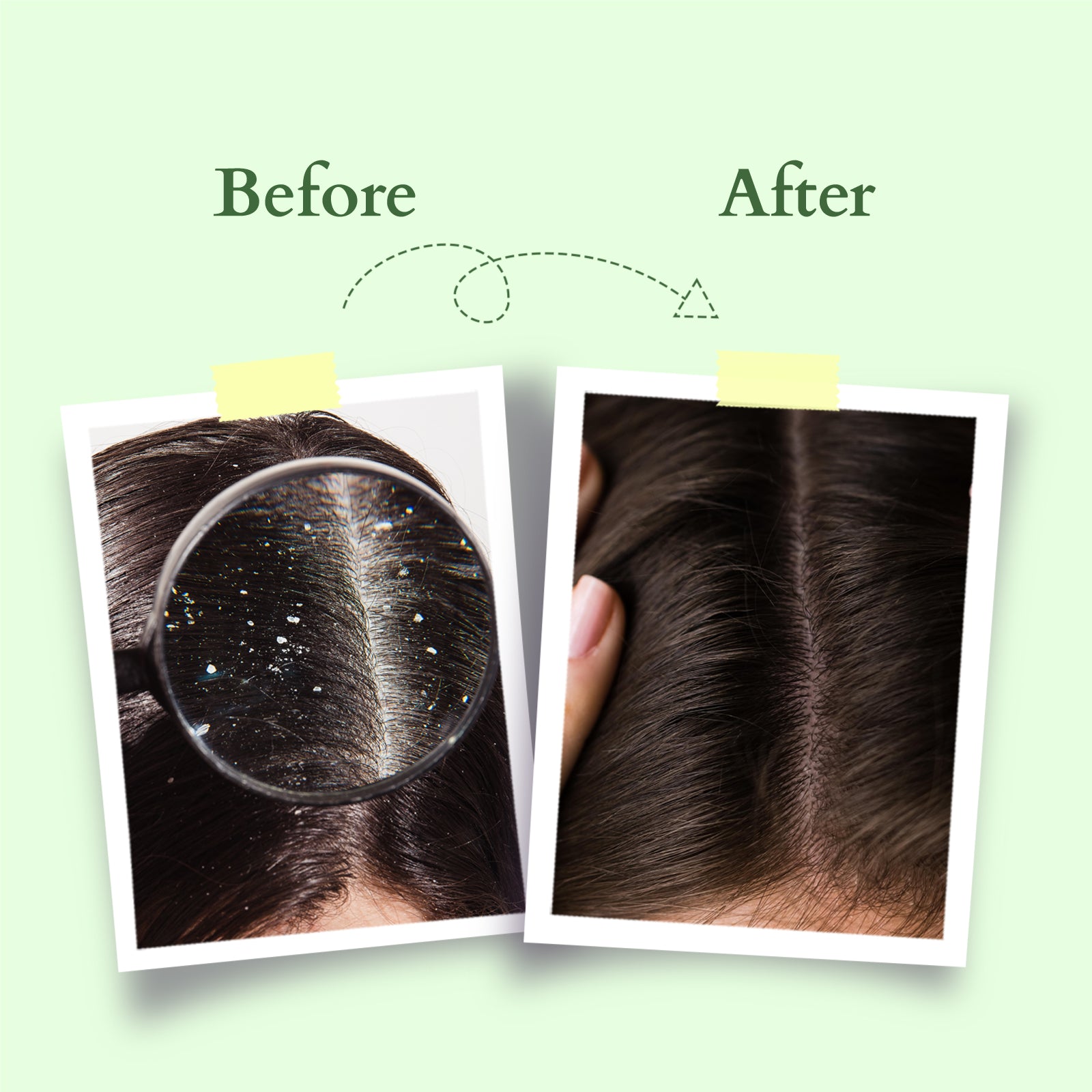 Organics+ Chemical-Free Anti-Dandruff Shampoo